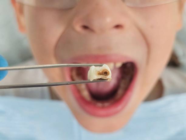 Best Cosmetic Emergency Dentistry in Starbuck, MN